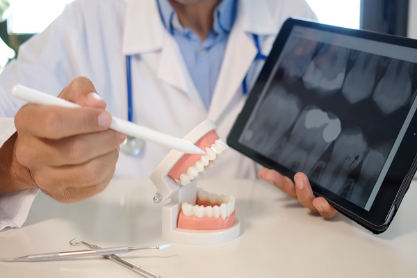 Symptoms That Indicate You May Need A Root Canal